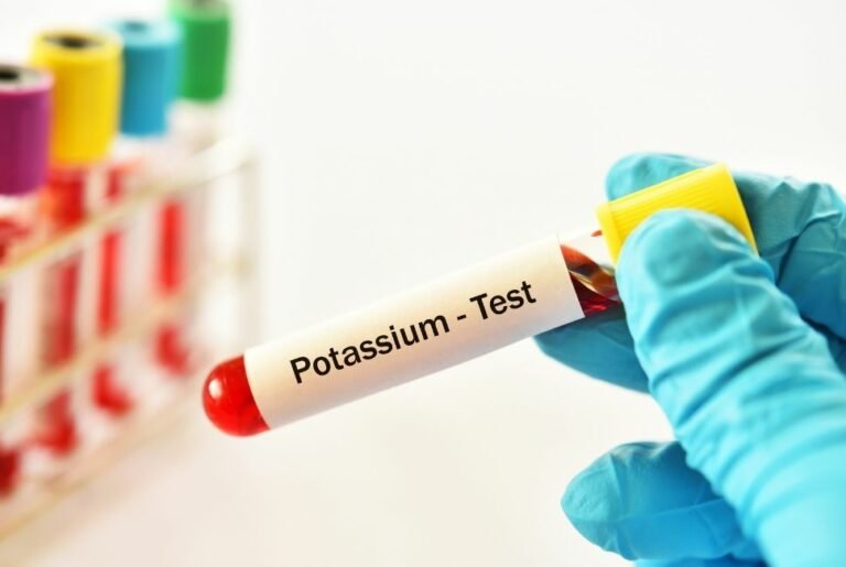 manque-de-potassium-et-depression